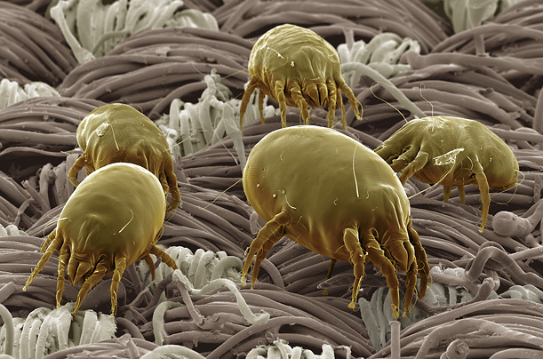 Carpet sanitising1 microbes in dirty carpet